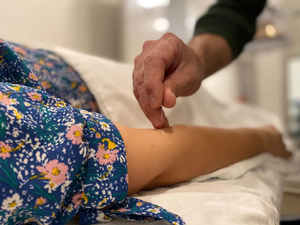 Acupuncture That Comes to You