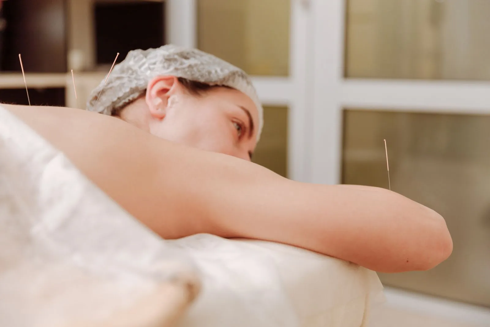 How Acupuncture Appointments Work at Home